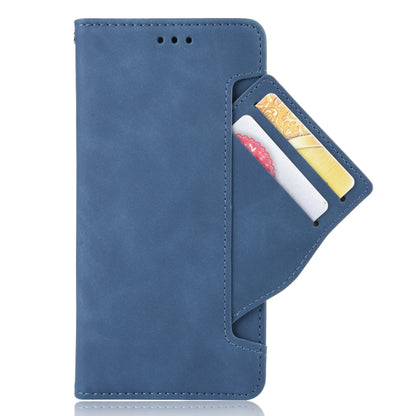 For Doogee S96 Pro Skin Feel Calf Pattern Leather Phone Case(Blue) - Doogee Cases by buy2fix | Online Shopping UK | buy2fix