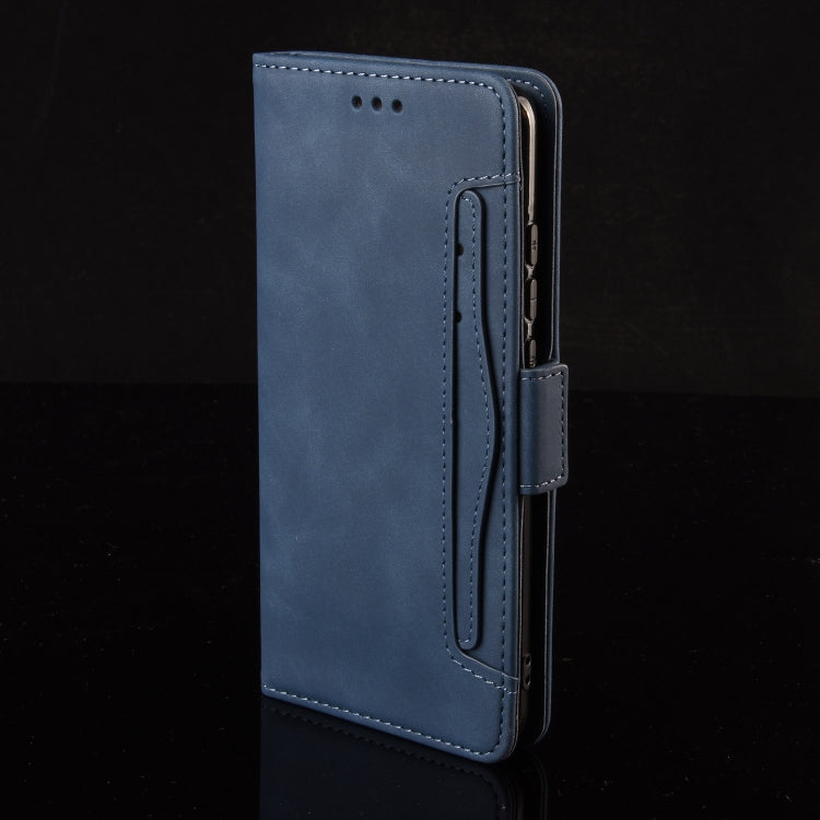 For Sony Xperia 10 VI 2024 Skin Feel Calf Texture Card Slots Leather Phone Case(Blue) - Sony Cases by buy2fix | Online Shopping UK | buy2fix