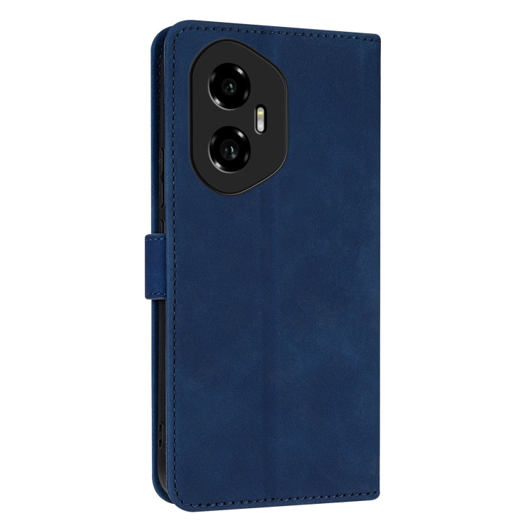 For Honor 300 AZNS Skin Feel Calf Texture Flip Leather Phone Case(Blue) - Honor Cases by AZNS | Online Shopping UK | buy2fix