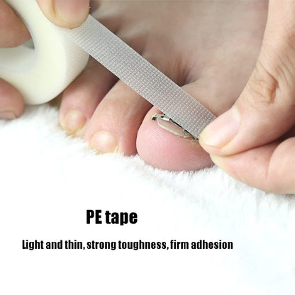 Orthopedic Buckle Toe Nail Groove Ingrown Nail Corrector, Style:No. 42, Specifications:Set - Corrector by buy2fix | Online Shopping UK | buy2fix